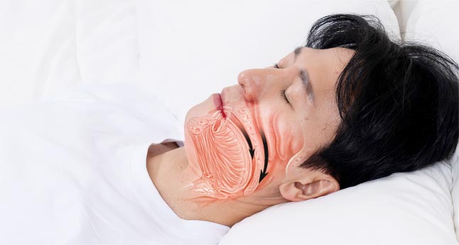 cpap 사용 전