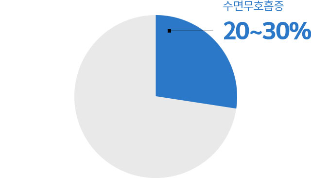 수면무호흡증 20~30%